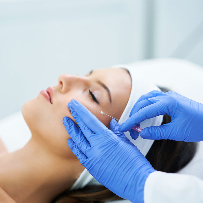 Woman receives facial thread lifting through professional wellness treatment at the Arkona Strandhotel in Binz on Rügen.